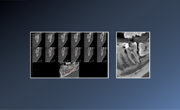 Did this Patient Require a CBCT? – 24th Jan 2022