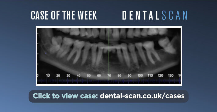 Case of the Week – Benign or Malignant?