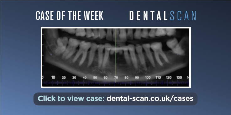 Case of the Week – Benign or Malignant?