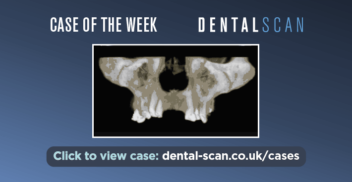 Case Of The Week – 👩‍⚕️ Review by ENT…