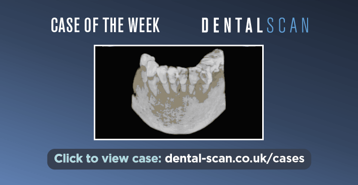 Case Of The Week – 🙀 Four Lesions Combine As One 🙀