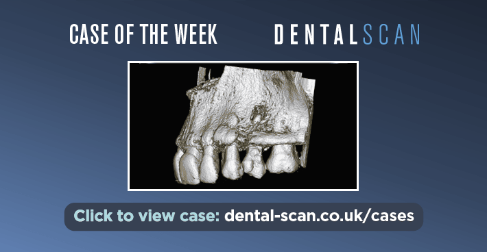 Case Of The Week – The Double Crown