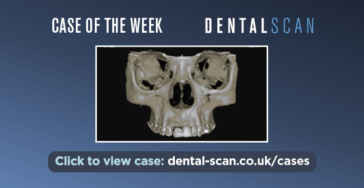 Case Of The Week – Kink in the Tooth!? – June 30, 2024
